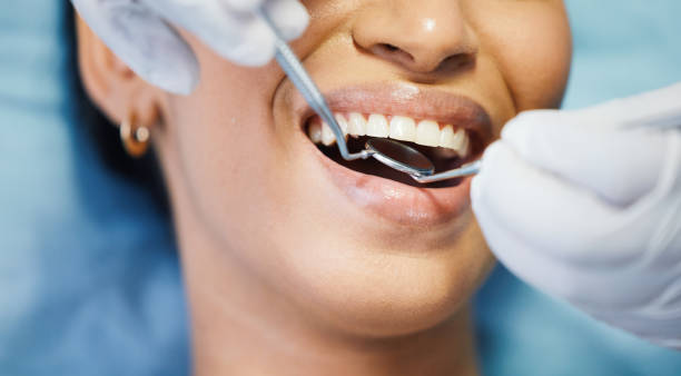 Fast & Reliable Emergency Dental Services in GA